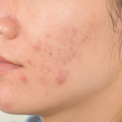 médico estético barcelona